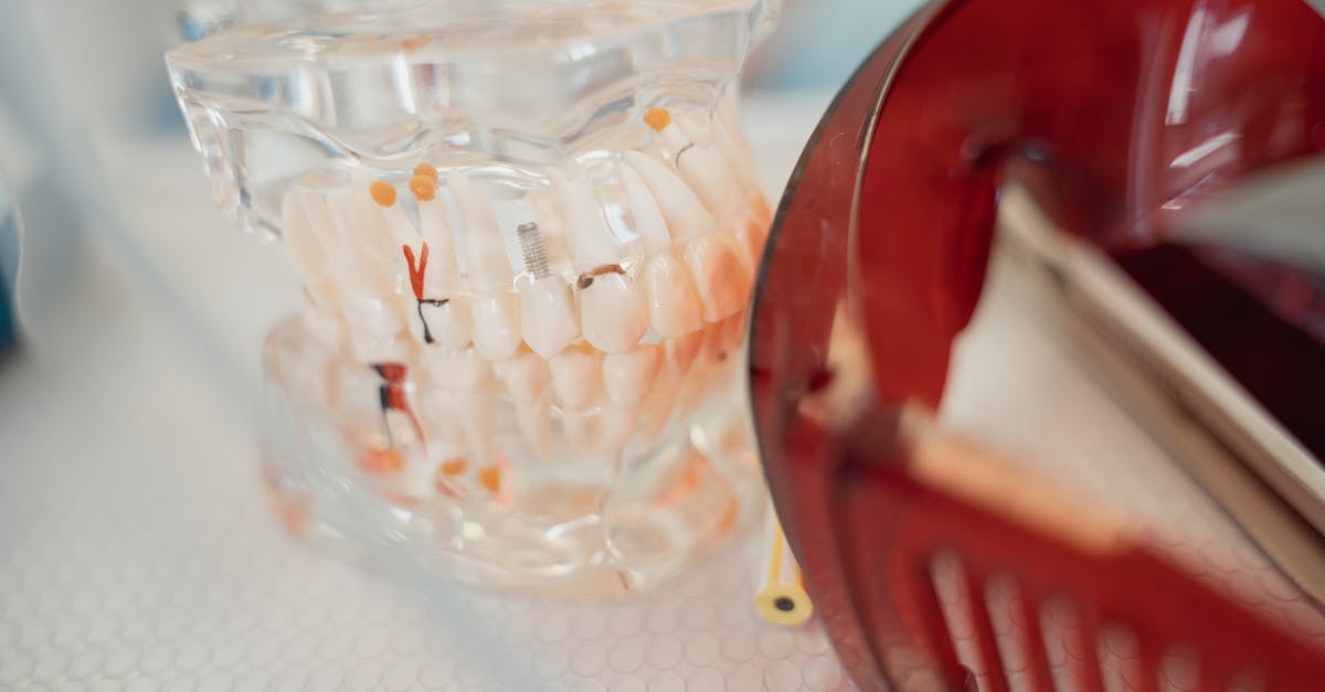 Can you get just one tooth implant?