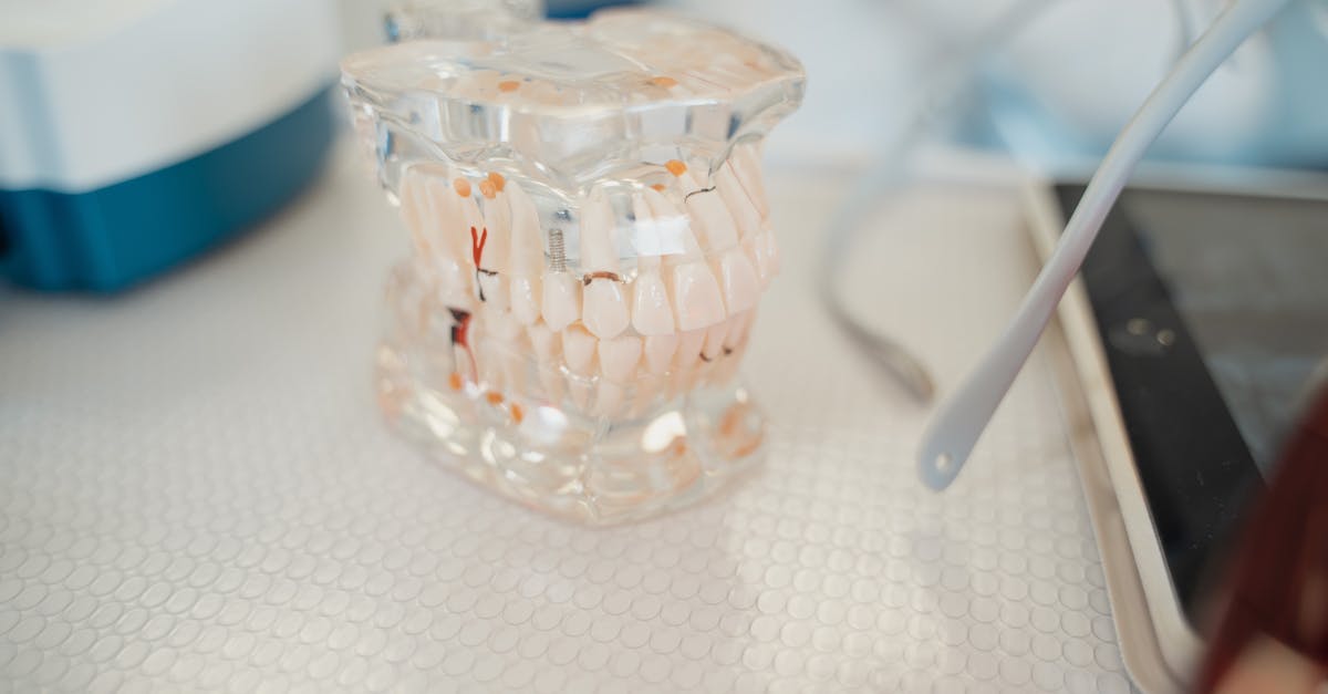 How long before dental implants feel normal?