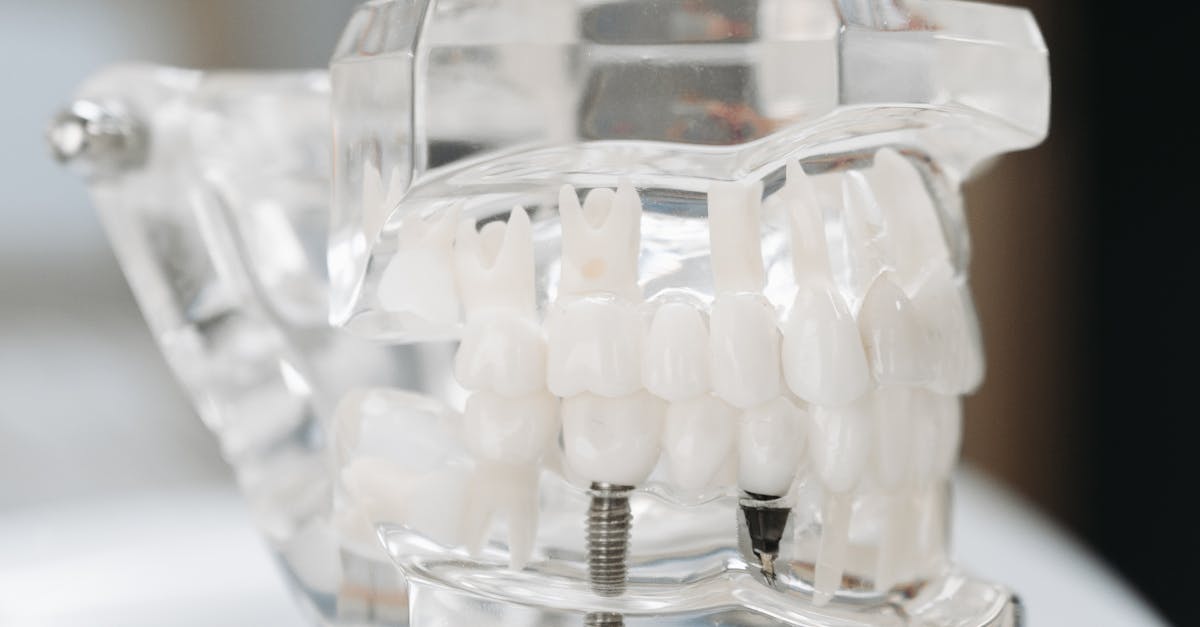 How to fix missing teeth without implants?