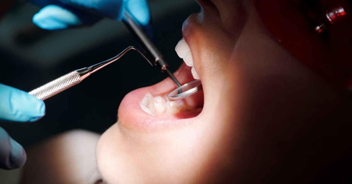 Is there a downside to dental implants?