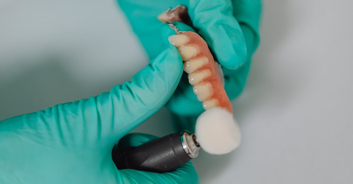 What are the signs of dental implant infection?