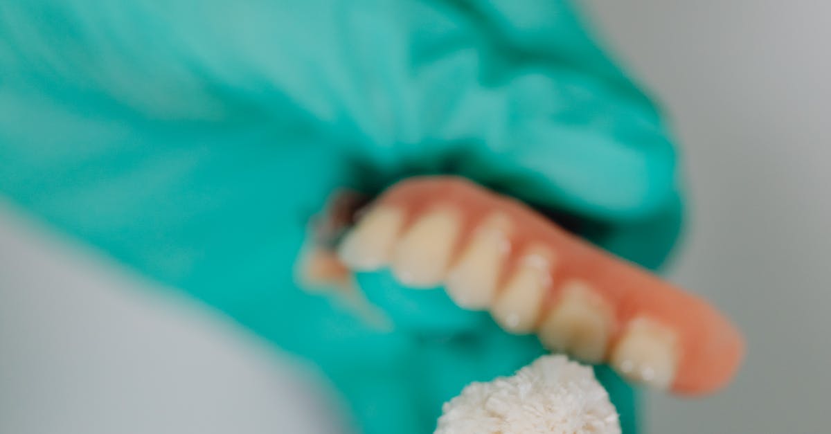 Who Cannot have dental implants?