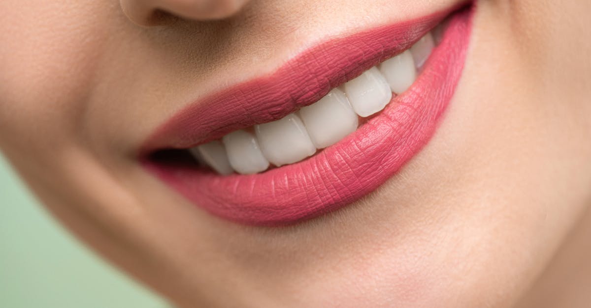 Why are single tooth implants so expensive?