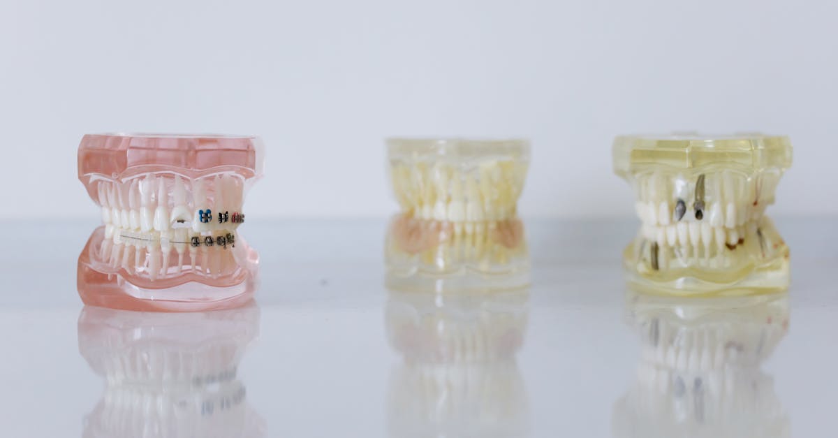 Why do gums recede around implants?