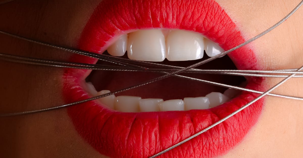 Why is it so cheap to get your teeth done in Turkey?